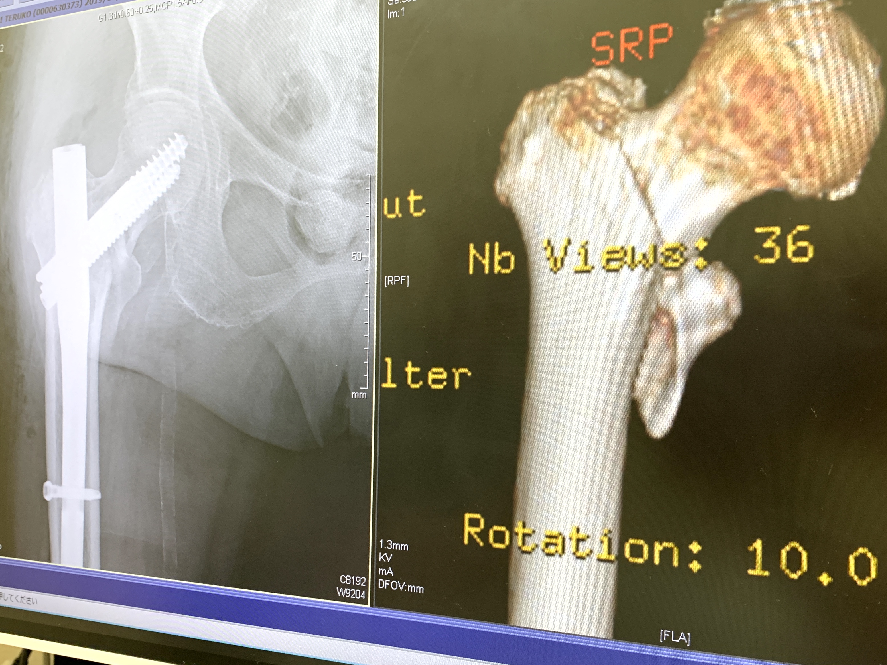 無事手術終わりました🏥